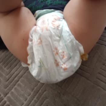 Prima Bezlerde Kalite Düşüşü Bebeğimde Ciddi Yaralara Yol Açtı
