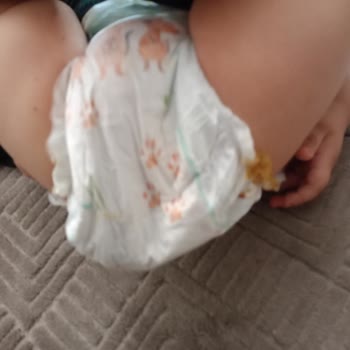 Prima Bezlerde Kalite Düşüşü Bebeğimde Ciddi Yaralara Yol Açtı