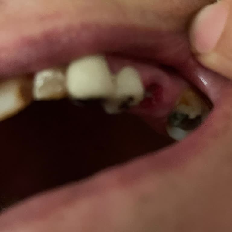 Diş Kaplaması Sonrası Ağrı Ve Doktorun İlgisiz Tavrı Nedeniyle Mağduriyet Yaşadım