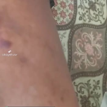 Bir Vatandaşın Acil Sağlık Çağrısı, Kimse Yok Mu Yardım Edecek