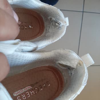 Ayakkabı Dünyası Kısa Sürede Deforme Olan Ayakkabılar Ve Yetersiz Mağaza Çözümü