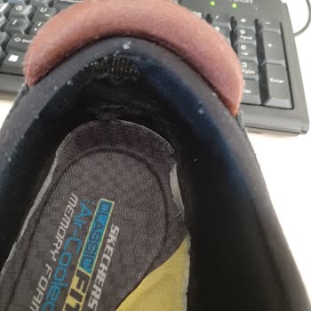 Ayakkabı Dünyası Kısa Sürede Deforme Olan Ayakkabılar Ve Yetersiz Mağaza Çözümü