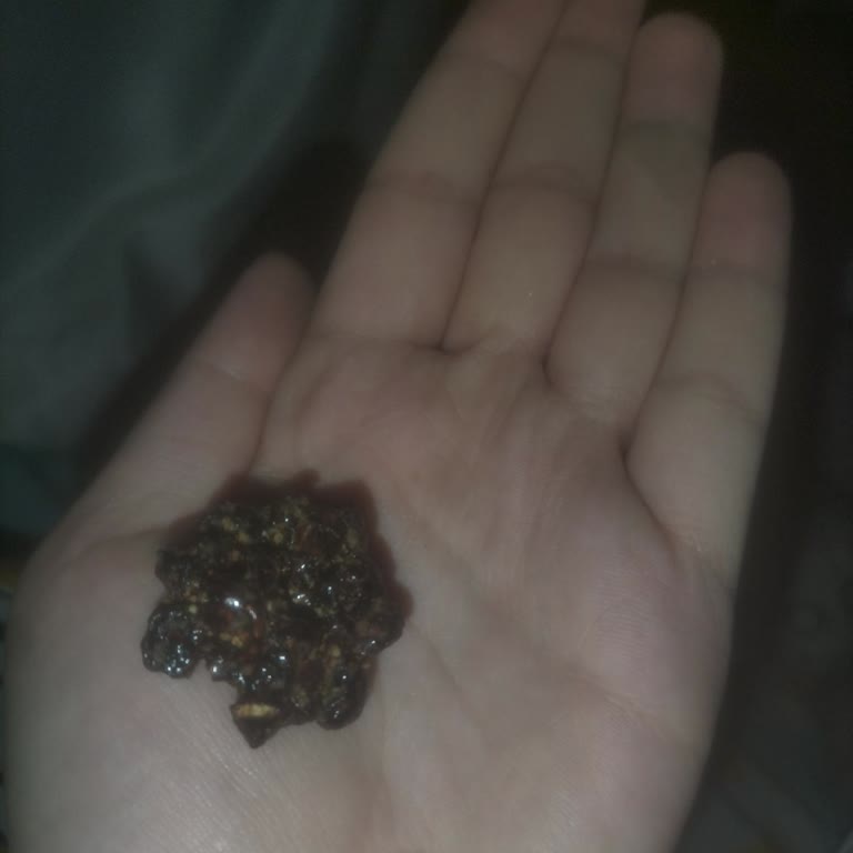 Yanmış Ve Sağlıksız Ürünle Karşılaştım