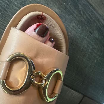 Hijyen Eksikliği Nedeniyle Hayal Kırıklığı Yaşadım