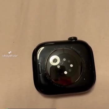 Apple Watch 10 Serisi Boya Soyulması