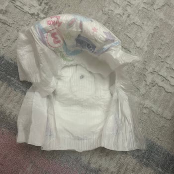 Bebek Bezinde Metal Parça Şoku