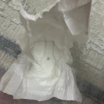 Bebek Bezinde Metal Parça Şoku