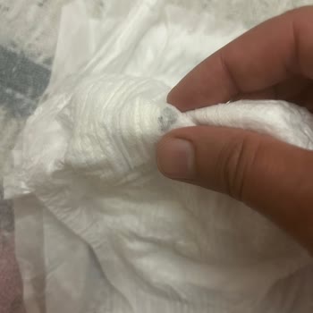 Bebek Bezinde Metal Parça Şoku