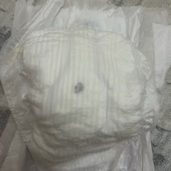 Bebek Bezinde Metal Parça Şoku