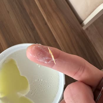 Yoğurt İçinde Yabancı Maddeyle Karşılaştım, Mağduriyetimin Giderilmesini İstiyorum