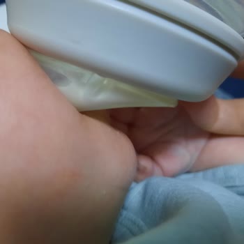 Chicco Biberon Meme Ucu Sorunu Ve Süt Akıntısı