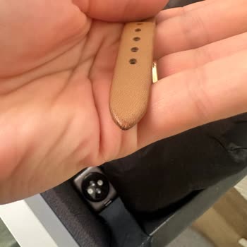 Fossil Saatte Tekrarlayan Kordon Sorunu Ve Yetersiz Çözüm