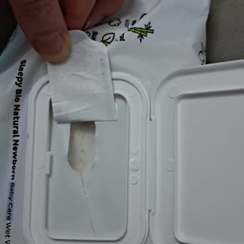 Bebek Islak Mendilinde Küf Ve Kötü Koku: Sağlık Riski Ve İade Talebi