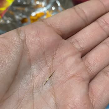 Patos Cips Paketinde Kesici Metal Parça Buldum, Sağlık Riski Yaşadım