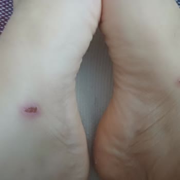 Greyder Terlik Ayaklarımı Yaraladı İade Talebim Reddedildi