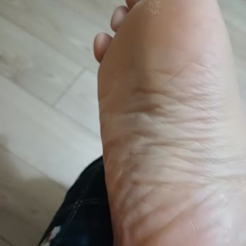 Greyder Terlik Ayaklarımı Yaraladı İade Talebim Reddedildi