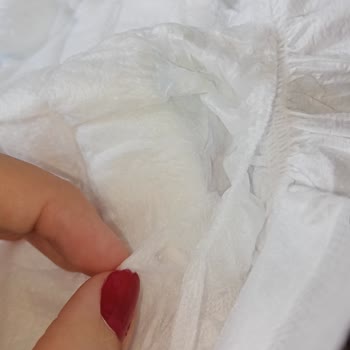 Molfix Bebek Bezinde Üretim Hatası Ve Cilt Tahrişi Şikayeti