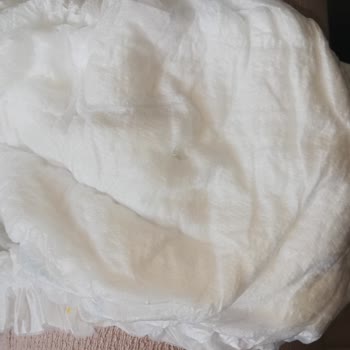 Molfix Bebek Bezinde Üretim Hatası Ve Cilt Tahrişi Şikayeti