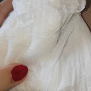 Molfix Bebek Bezinde Üretim Hatası Ve Cilt Tahrişi Şikayeti