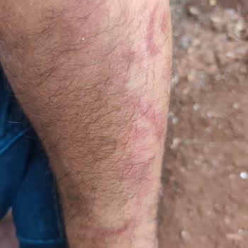 Enerji İçeceği Sonrası Ciddi Sağlık Sorunları Ve Mağduriyet