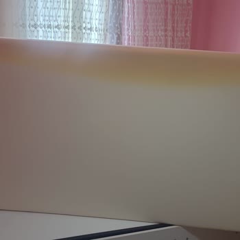 Yataklarda Sararma Sorunu Ve Firma Tarafından Çözüm Sunulmaması