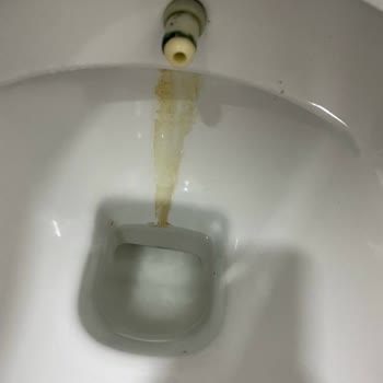 Otel Fotoğrafları Gerçeği Yansıtmıyor Ve Ücret İadesi Yapılmıyor