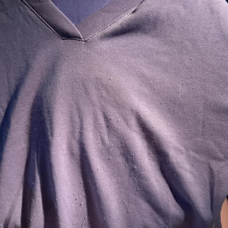 Satın Aldığım Ürünlerde Kısa Sürede Tüylenme Ve Mağazadan Çözüm Alamama Sorunu