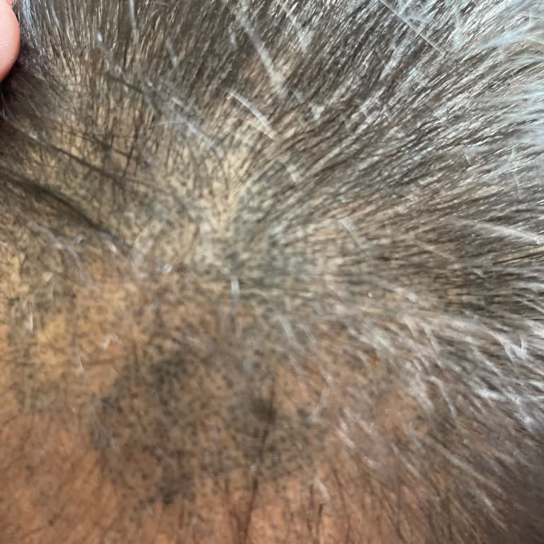 İşlem Sonrası Renk Değişimi Ve Çözüm Sunulmayan Mağduriyet