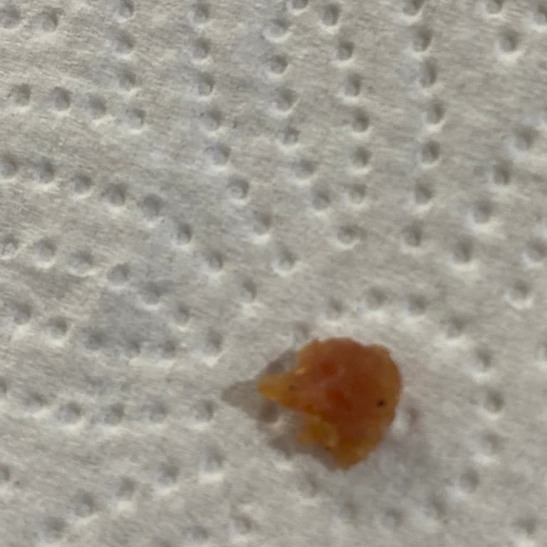 A101den Alınan Mantının İçinden Kıkırdak Çıktı Ürün Güvenliği Endişesi