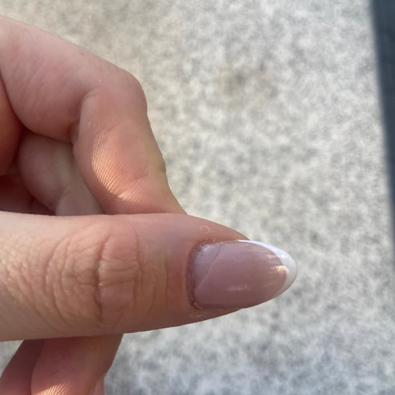 Sena Nail Beauty Ankara'da Yapılan Başarısız İşlem