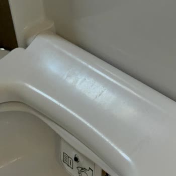 Vitra Sento Rimex Klozet Kapaklarında Kısa Sürede Oluşan Lekeler Ve Görüntü Sorunu