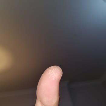 Vanish Kosla Jel Kullanımı Sonrası Cilt Tahrişi Ve Müşteri Hizmetlerine Ulaşamama