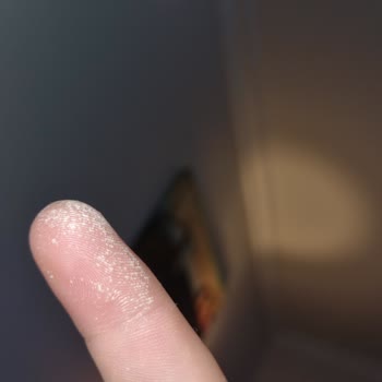 Vanish Kosla Jel Kullanımı Sonrası Cilt Tahrişi Ve Müşteri Hizmetlerine Ulaşamama