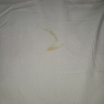 Side Win Hotelde Temizlik Sorunları Ve İlgisiz Personel Tatil Keyfini Mahvetti