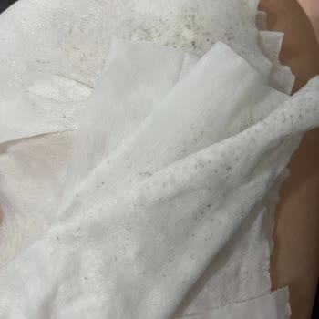 Yeni Alınan Islak Mendillerde Küflenme Sorunu Ve Mağduriyet