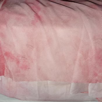 İade Edilen Elbise Lekeli Denilerek Ücretim İade Edilmedi