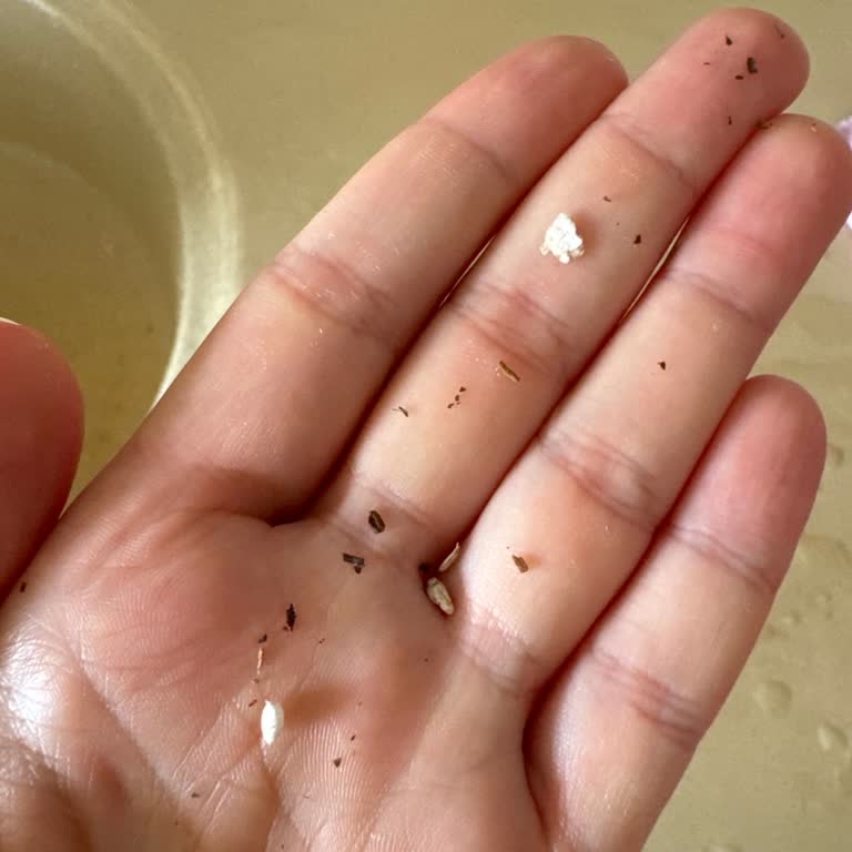 Doğuş Çay Paketinde Yabancı Madde Çıkması Ve Para İadesi Talebi