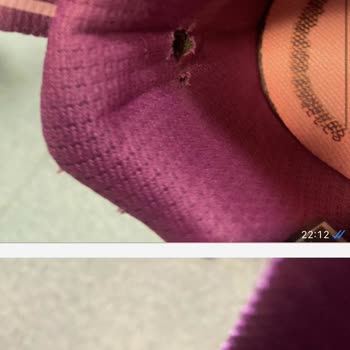 Kısa Sürede Yıpranan Ayakkabıma Skechers’tan Çözüm Bekliyorum