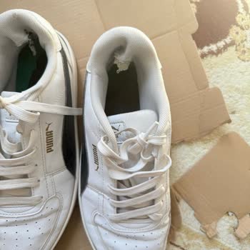 Kısa Sürede Açılan Ayakkabı Ve Yetersiz İnceleme Raporu Mağduriyeti