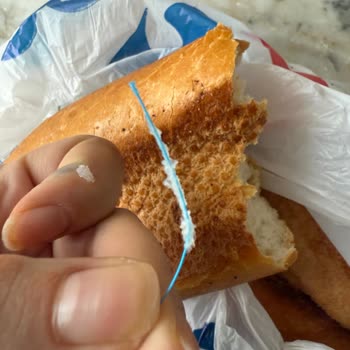 Somun Ekmeğin İçinden Tel Çıktı, Sağlığım Tehlikeye Girdi