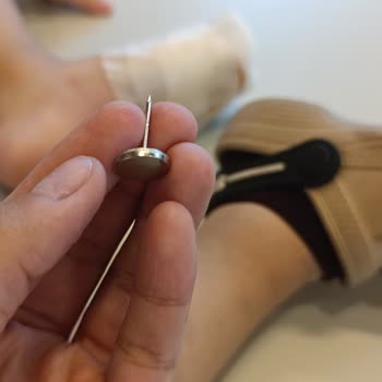 E-bebek Mağazasında Oğlumun Ayağına Batan Alarm İğnesi Ve İlgisiz Personel