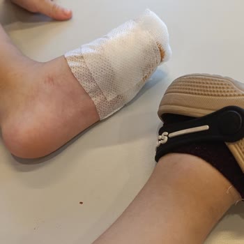 E-bebek Mağazasında Oğlumun Ayağına Batan Alarm İğnesi Ve İlgisiz Personel