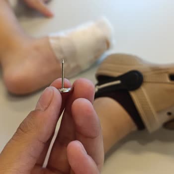 E-bebek Mağazasında Oğlumun Ayağına Batan Alarm İğnesi Ve İlgisiz Personel