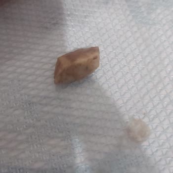 Soslu Mısır Paketinden Çıkan Taş Dişimi Kırıyordu, Acil Açıklama Bekliyorum