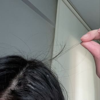 Saç Kaynağı Sonrası Kopma Ve Tehdit İçeren Mesajlarla Yaşadığım Mağduriyet