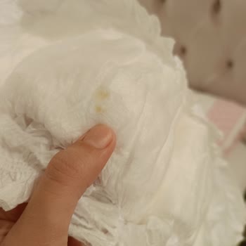 Bebek Bezinde Yapışkan Sorunu Ve Çocuğumun Sağlığı İçin Endişeliyim