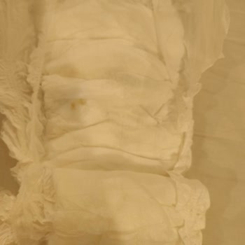 Bebek Bezinde Yapışkan Sorunu Ve Çocuğumun Sağlığı İçin Endişeliyim