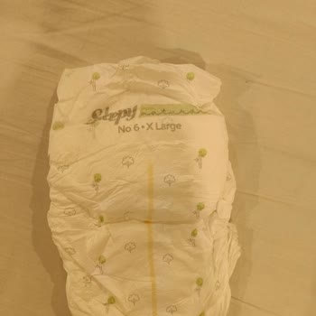 Bebek Bezinde Yapışkan Sorunu Ve Çocuğumun Sağlığı İçin Endişeliyim