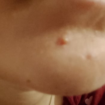 Orijinal Ürün Güvencesiyle Aldığım Bakım Seti Cildimde Ciddi Sorunlara Yol Açtı