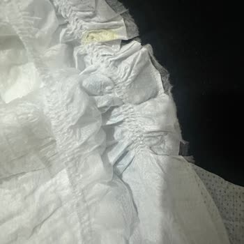 Bebek Bezinde Sakız Benzeri Madde Şoku: Sağlık Riski!